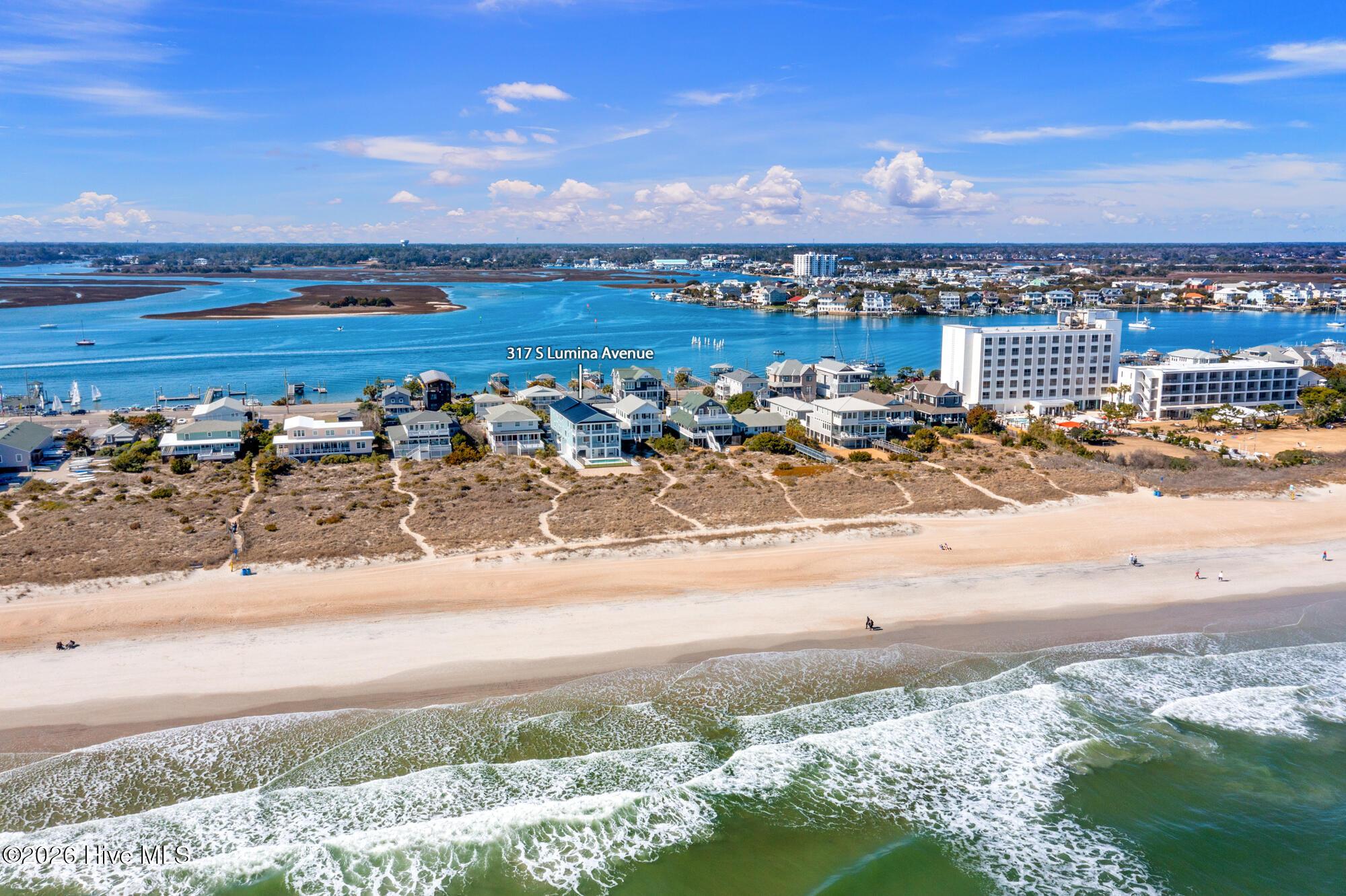 Image 4: 317 S Lumina Ave (3)